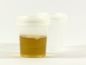 Urin-Test